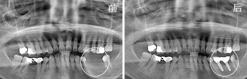 1470971614797283.jpg 500-160-治疗前后对比图.jpg