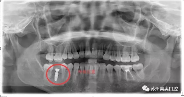 1489996523839589.jpg 9.webp.jpg