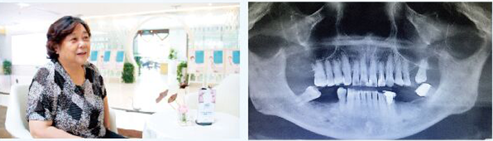 1497948989505586.png 11.png