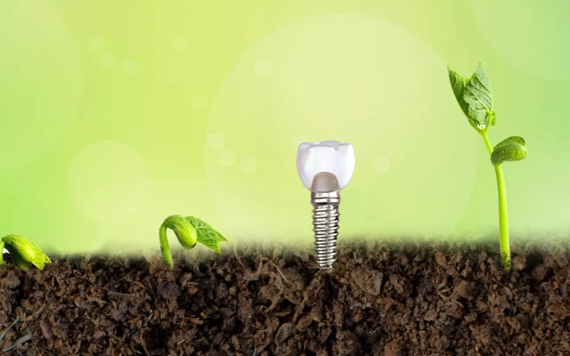 美奥口腔 全国连锁 640-wps图片.jpg