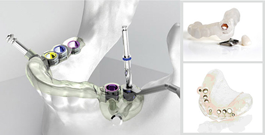 1457055817653648.jpg 335.jpg