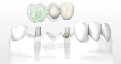 1482130763675927.jpg 993.jpg